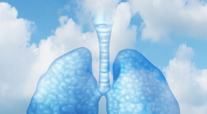 Opole chce oddychać